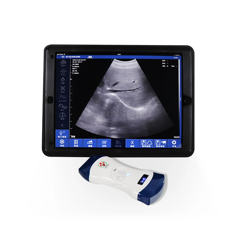 Sy-AC51 Potable Wireless128 Element Convex Color Doppler Ultrasound Probe