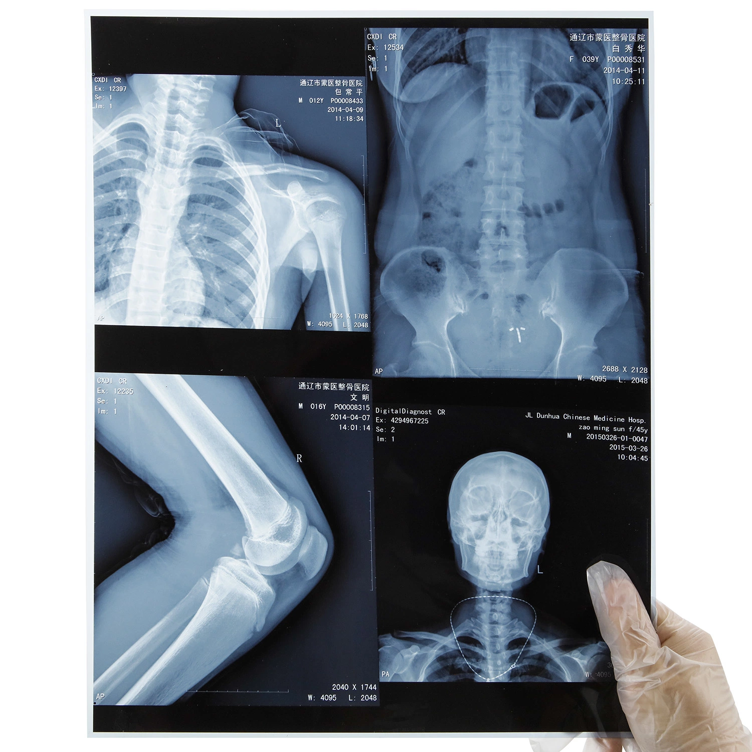 Medical Film Xray Image Printing Use Blue Xray Film Pet Medical Film