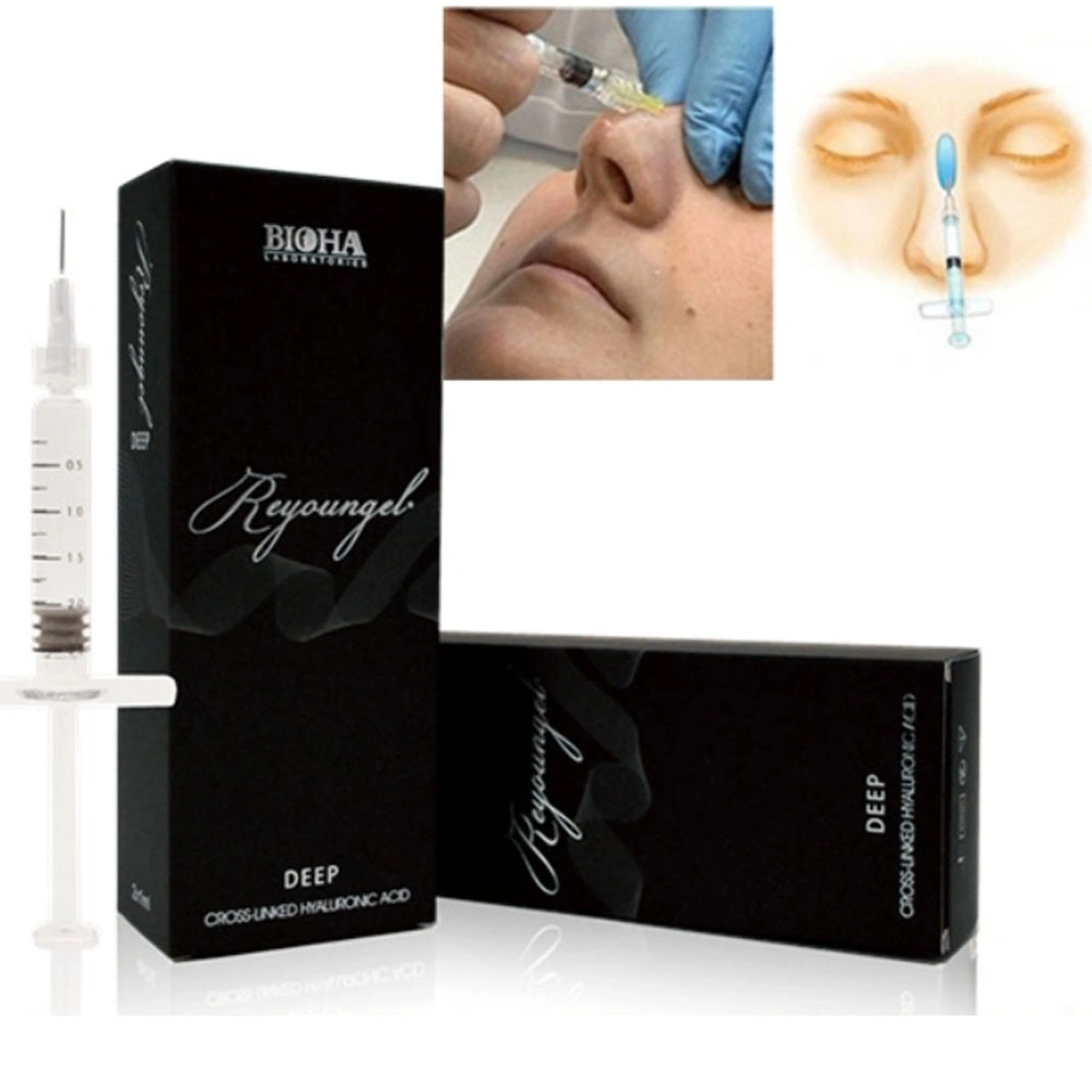 Reyoungel Brand Hyaluronic Acid Dermal Filler for Body Use