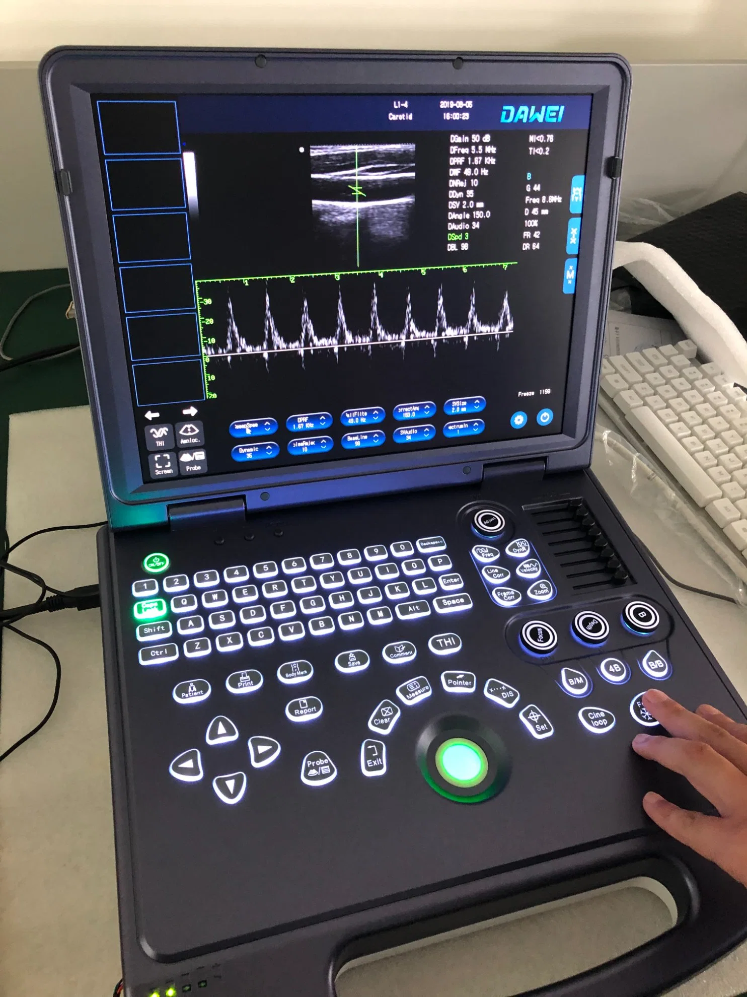 Appareil de diagnostic portable à ultrasons noir et blanc de veille ultra-longue durée abdominal Obstétrique