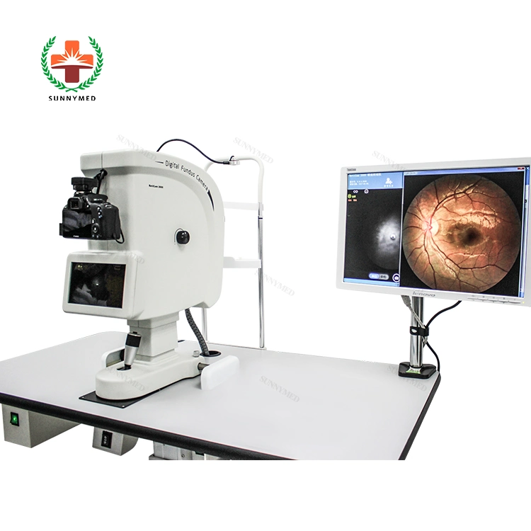 Sy-V036A Ophthalmic Digital Equipment Non-Mydriatic Fundus Camera