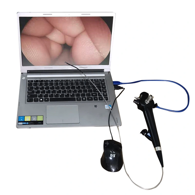 Animaux de compagnie vétérinaire semi-rigide Urologique ureteroscope Set vétérinaire numérique Urétéoscope vidéo flexible