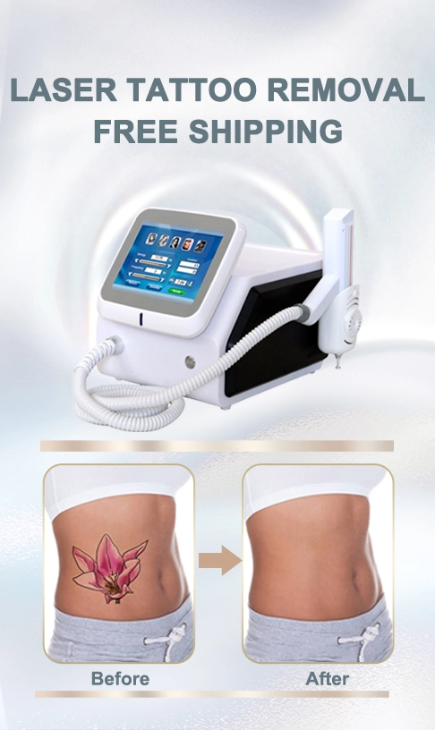 Newest Promotion Laser Pigment Therapy / Q Switch ND YAG Laser Tattoo Removal Equipment