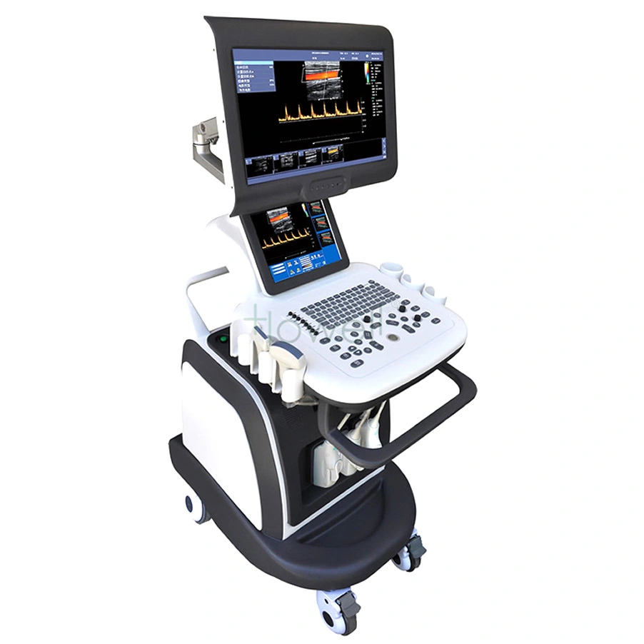 HE-S80 Color Doppler Ultrasound Diagnostic Device