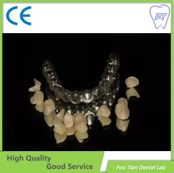 Gutes Produkt Zirkonia Krone und Brücke aus China Dental Labor