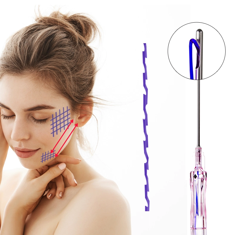 Molding Fios Absorbable Pdo Pcl Thread Lift Fios De Sutura Pdo PARA Lift Facial