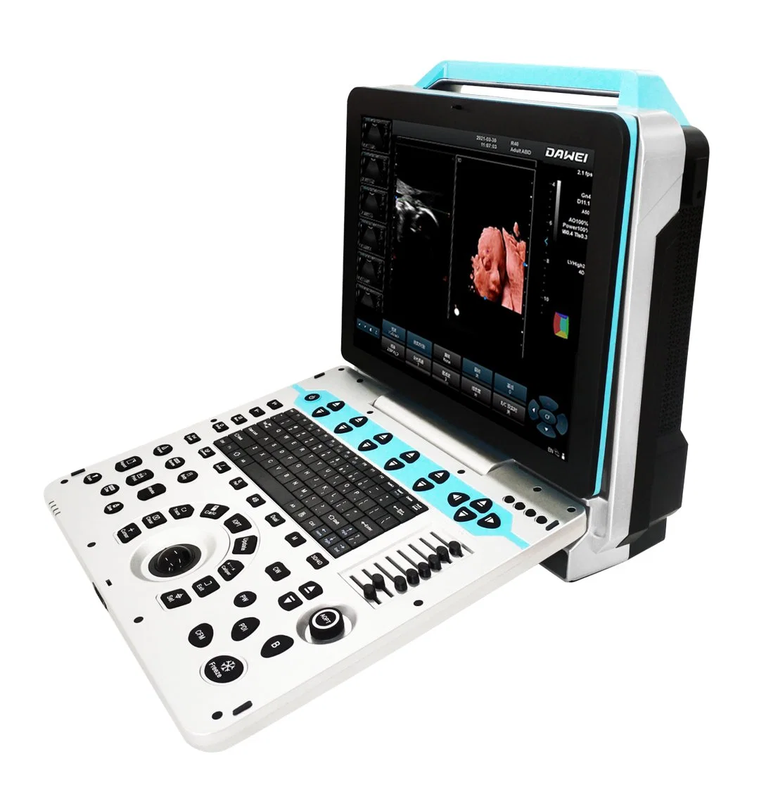 Original Factory Portable Obstetrics Color Doppler 3D/4D/5D Ultrasound with Low Price