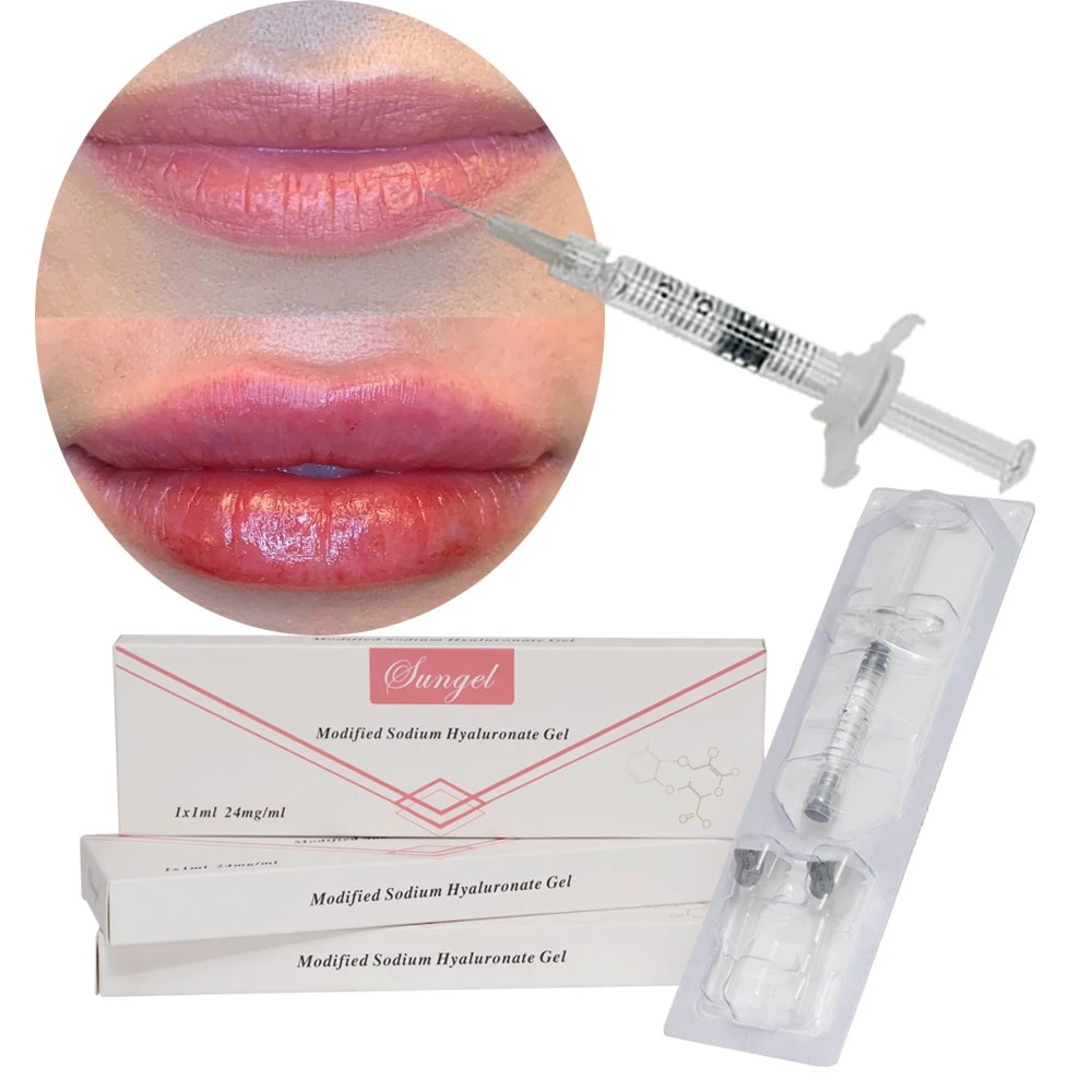 Fabriqué en Chine de fournitures médicales jetables éliminer les plis Implant injectable d'injection 1ml Bd lèvre de gros bouchon de remplissage