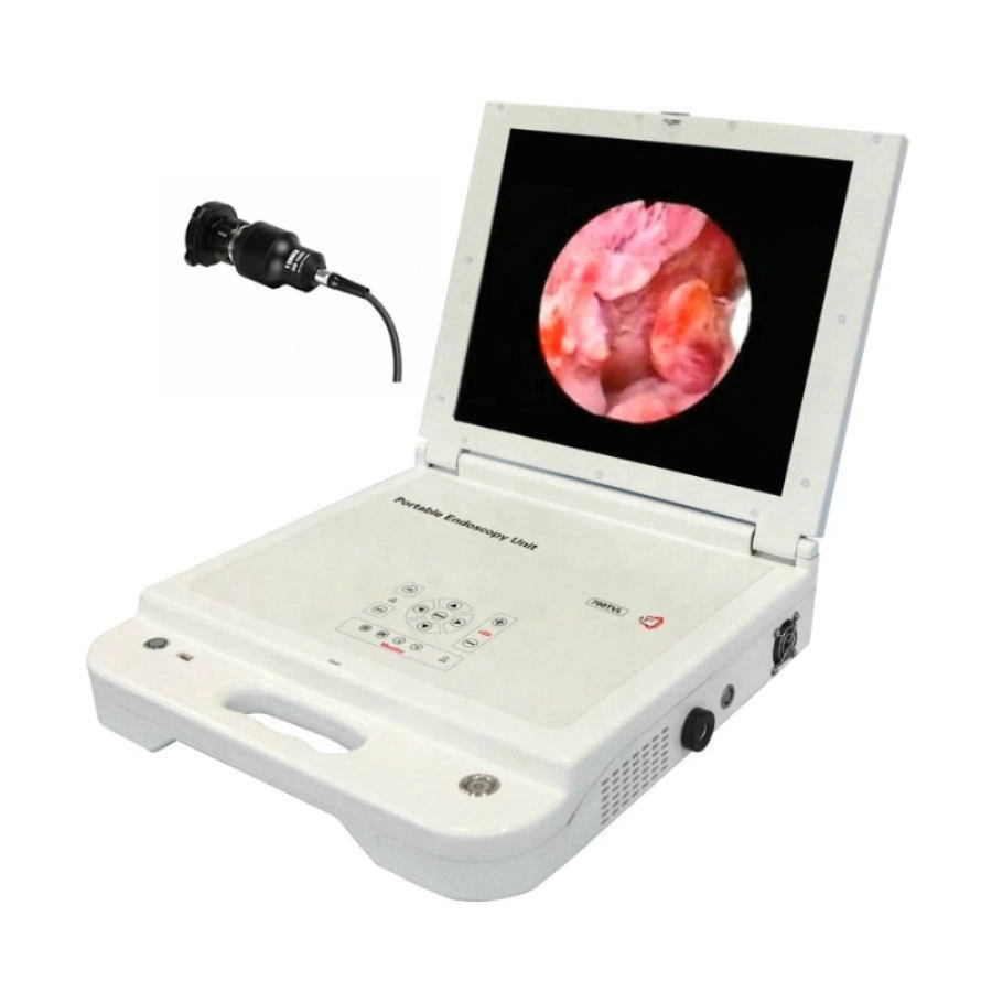 Portable HD Medical Monitor LED Light Source Ent CCD Endoscope Camera Portable Endoscopy Unit