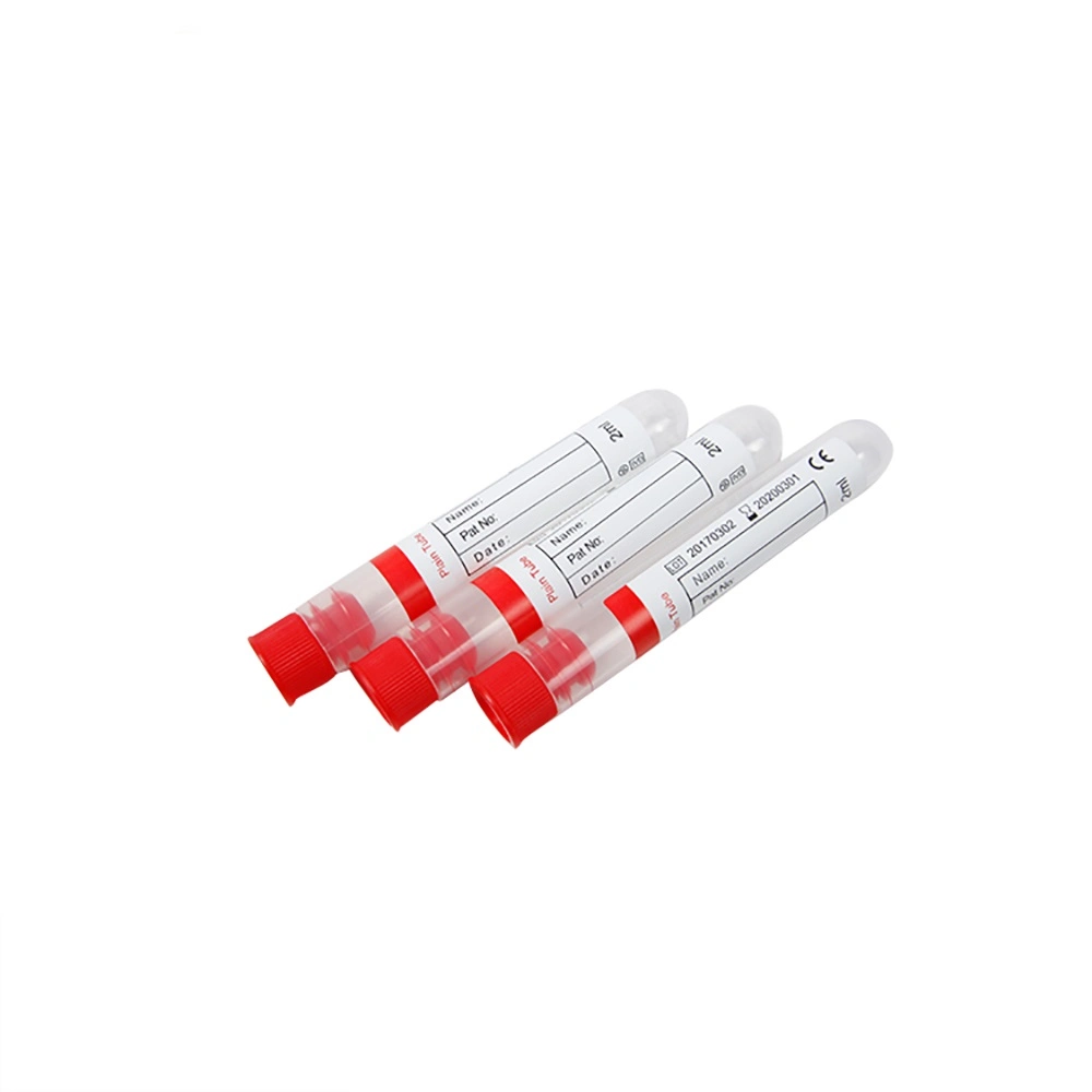 Laboratory Coagulation Test Sodium Citrate Vacuum Blood Collection PT Tube