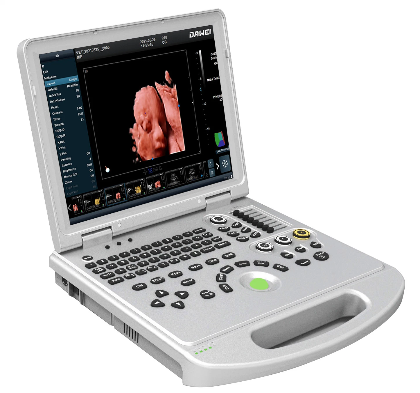 DW-L50 Notebook 4D/5D Ultraschall-Scanner mit Echthaut-Rendering für Farbdoppler