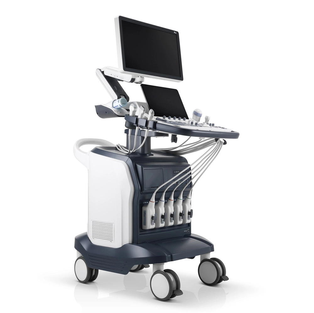 Sonoscape S60 13.3 Inch Quick Responsive Touch Screen Color Doppler Trolley Ultrasound Machine