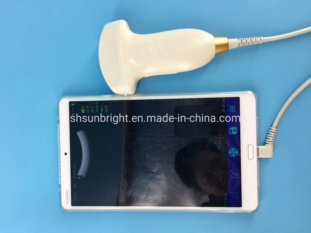 High Definition USB Convex Probe Ultrasound Ob Doppler Color 2020