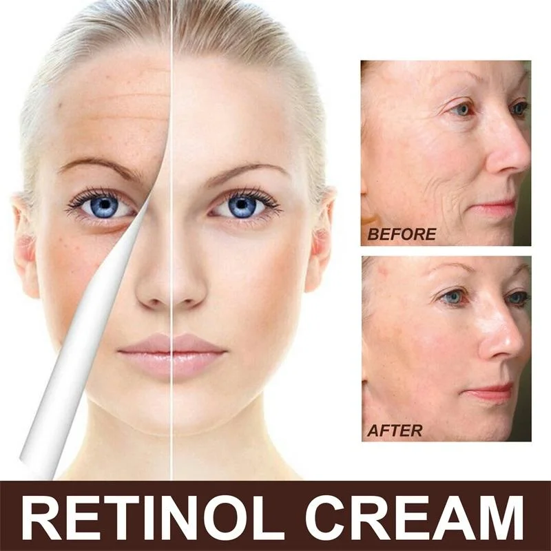 Remove Wrinkles Good Molecules Retinol Whitening Night Cream for Face