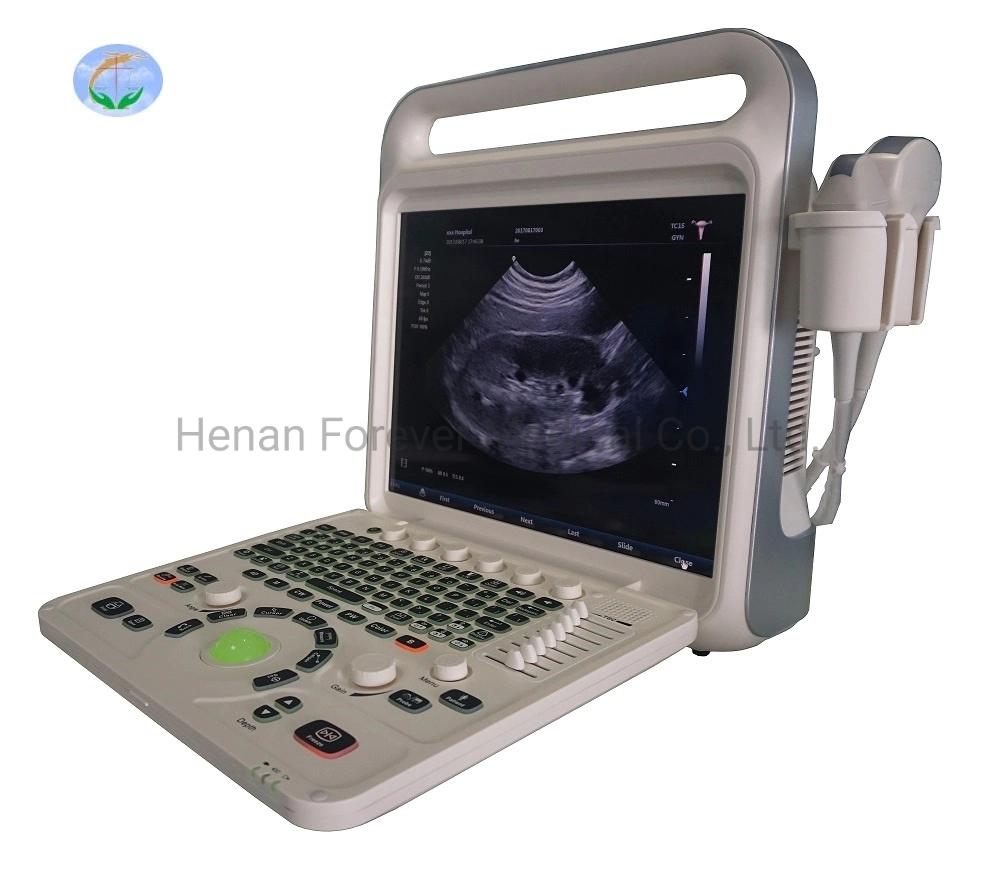 High End Laptop Color Doppler Ultrasound Diagnostic System with Low Price