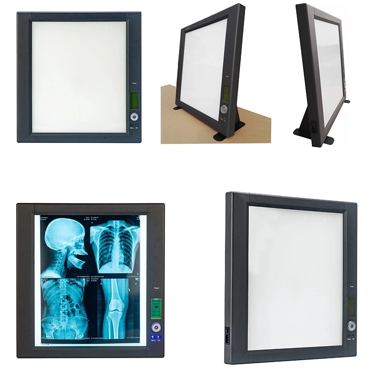 LED X-ray Film Illuminator Viewer Box