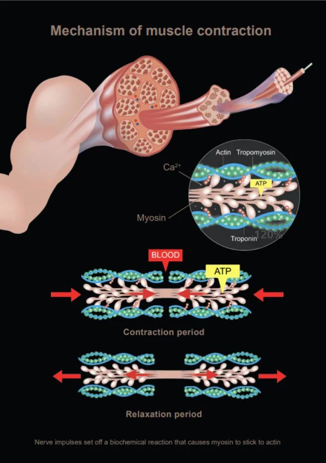 EMS Technologie Elektromagnetische Teslasculpt Abnehmen Ästhetik System EMS Body Contouring