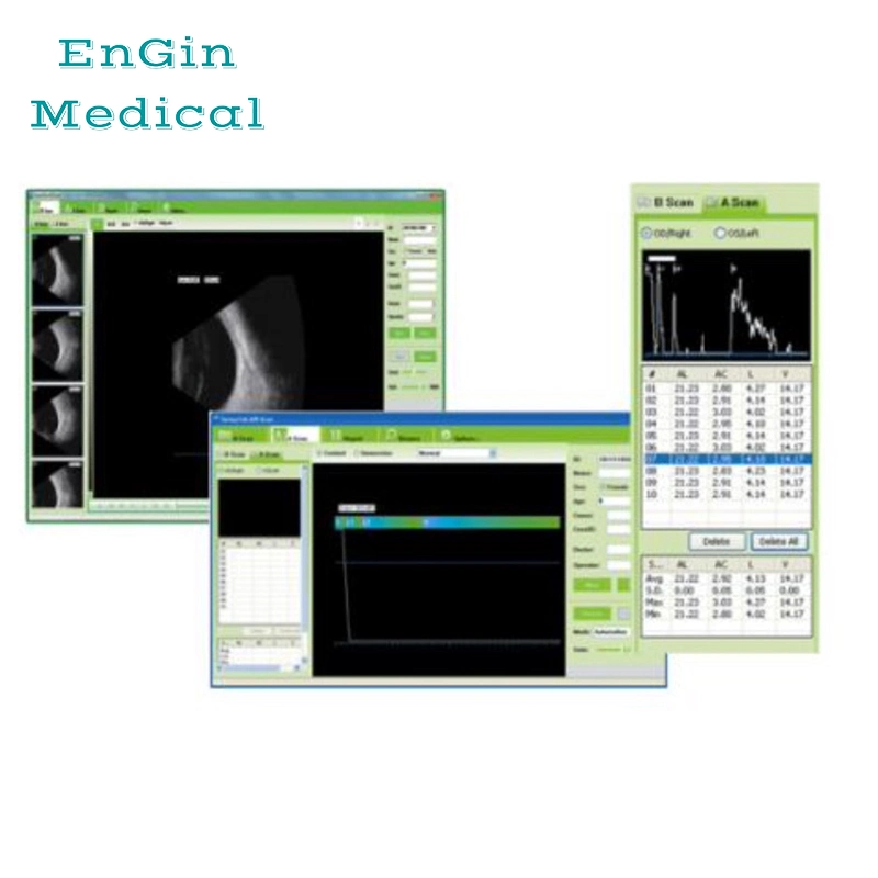 Ophthalmic Veterinary Ultrasound Scanner a/B Scanner ABS-300 Ab Scan Testing Equipment Ophthalmology Device Biometry Eye Scanner