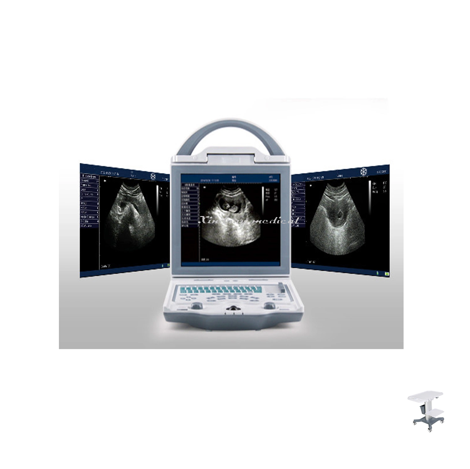 Portable Black and White Ultrasound Buy Ultrasound Scanner