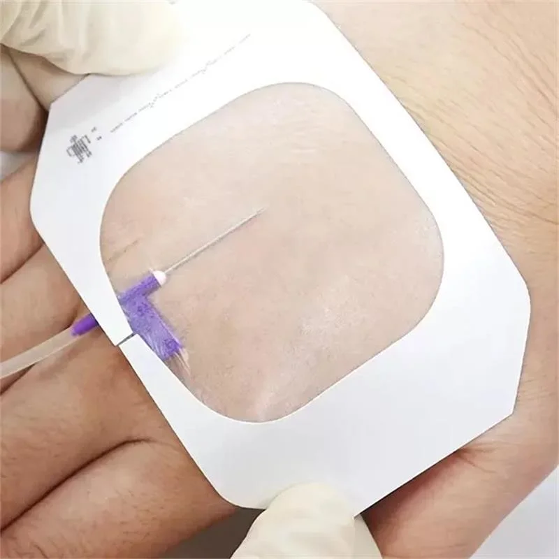 CE und FDA Krankenhausmaterial IV-Verband zur Katheterbefestigung Chirurgische PU-transparente Film Wunde Dressing