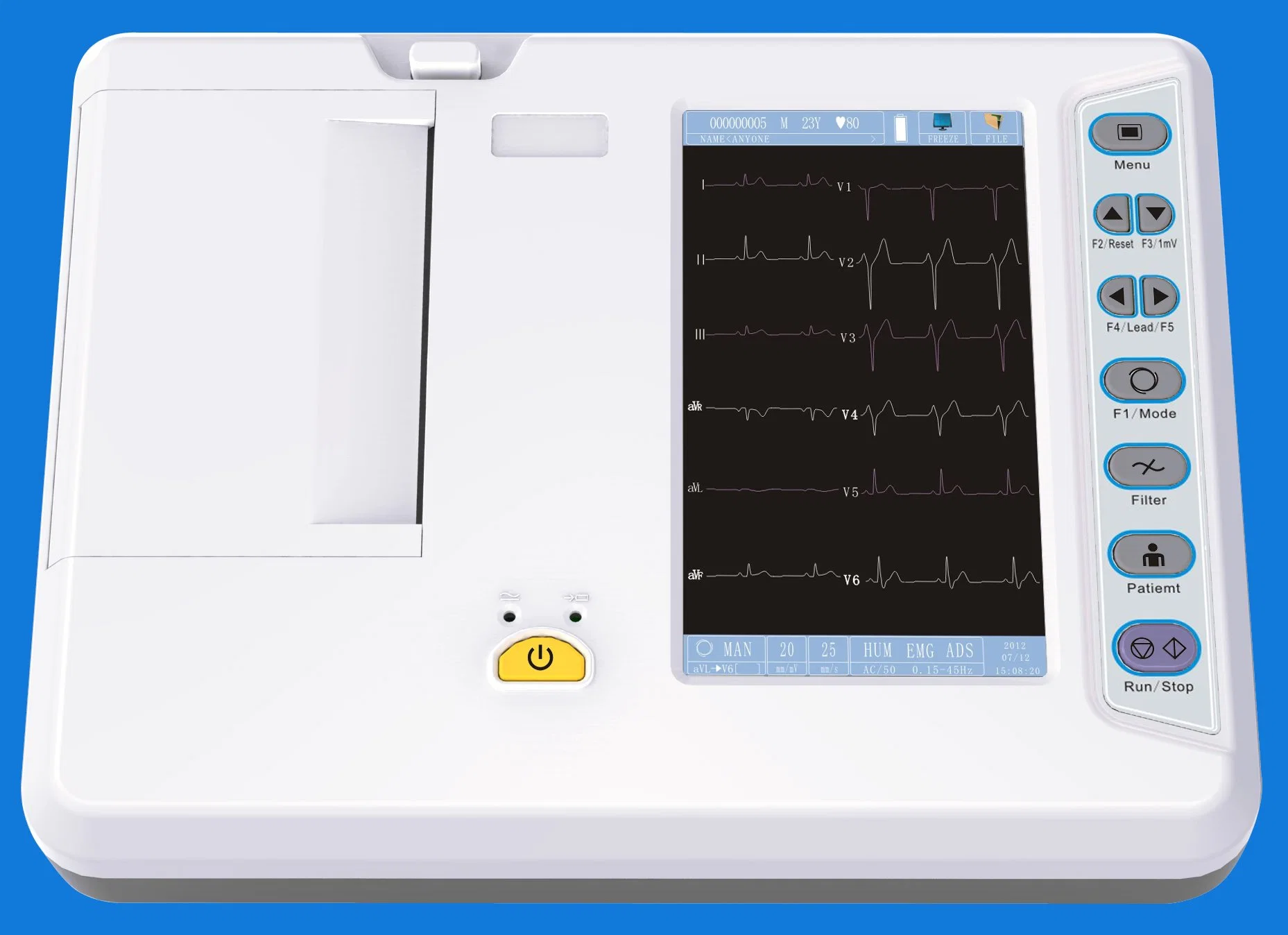 Máquina de ECG de 3 canales con aprobación CE/ISO para hospital (EKG03A)