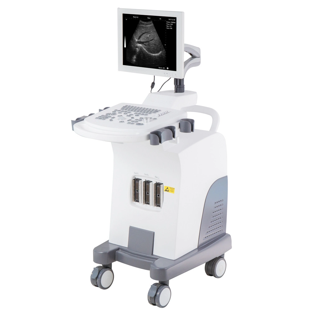 Trolley Type PC Based Vaginal B/W Mode Ultrasound Diagnostic System