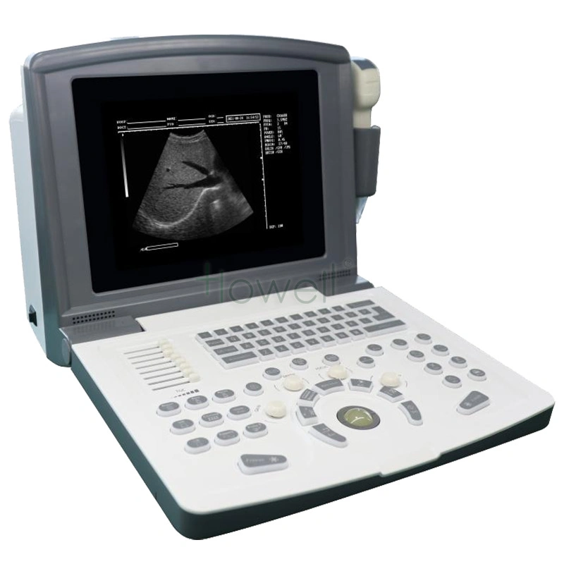 B/W Ultrasound Machine for Liver/ Gallbladder/Pancreas/Spleen Examination