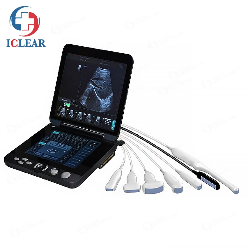 Portable Full-Digital Ultrasound System Notebook B/W Medical Ultrasound Scanner