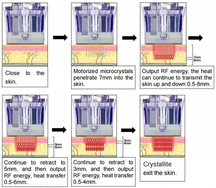 Profundidad de Crystallite profesional Morpheus 8 Gold RF máquina de microneedling fraccional Para la eliminación de las marcas de estiramiento