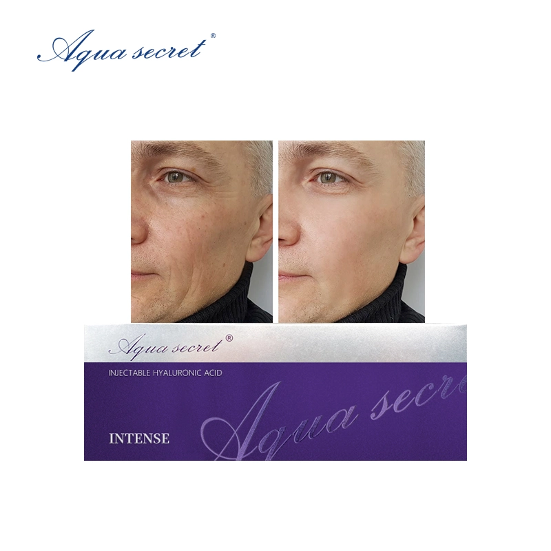 Aqua Secret 1ml 2ml Non Animal Cross Linked Hyaluronic Acid Dermal Filler Injection for Face Hyaluronic Acid Injection