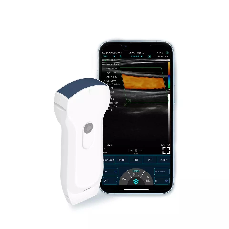 Medical 5g Wireless B/W Linear Portable Ultrasound Probe