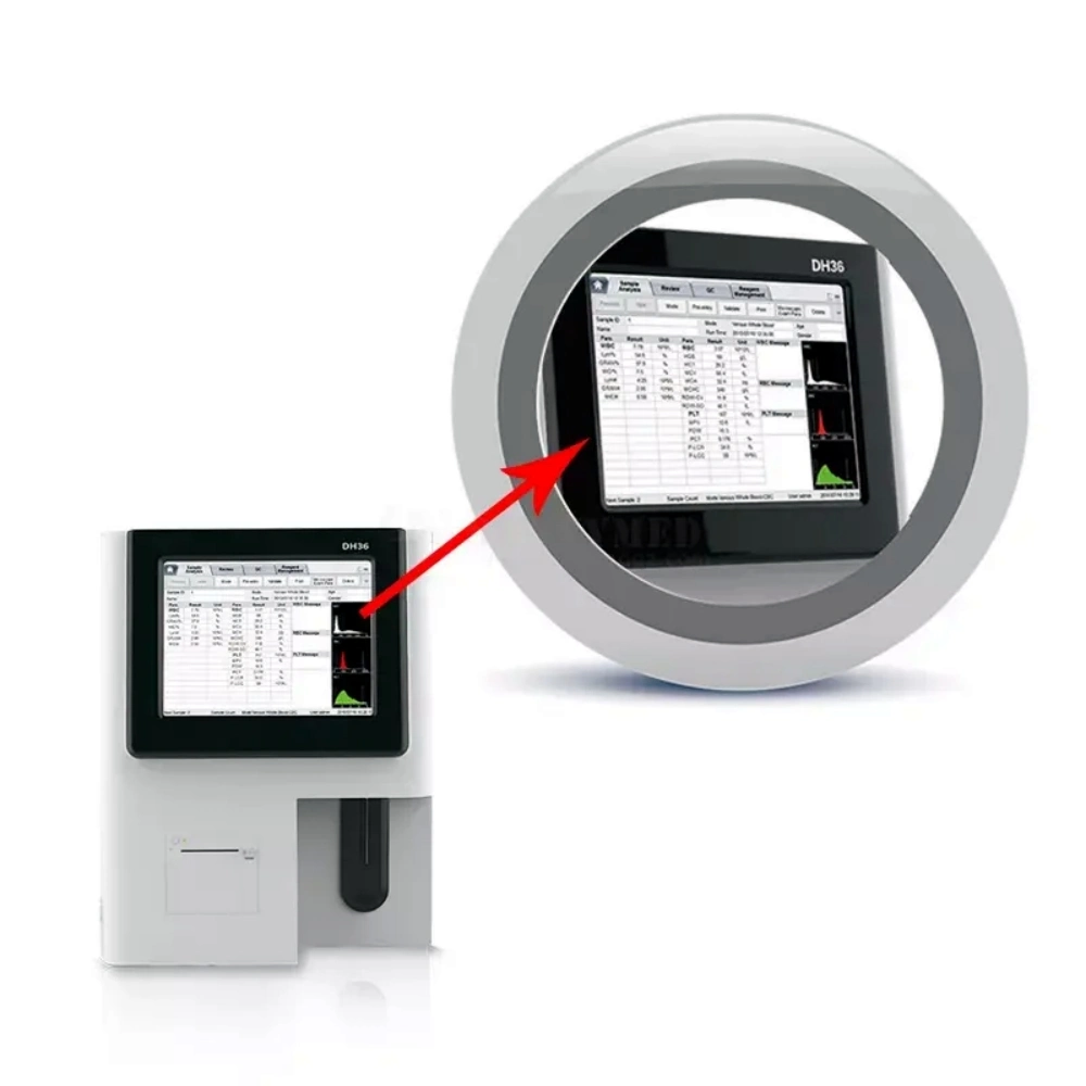 Dymind Dh36 10,4 Zoll TFT Touchscreen Medical Hematology Analyzer Cbc Bluttestgerät Tragbares Vollautomatisches Hämatologie-Analysegerät