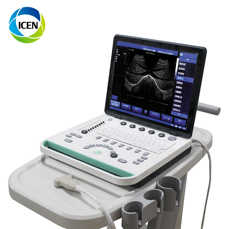 IN-A032-2 ICEN Portable Digital Ultrasound Machine Pregnancy Equipment