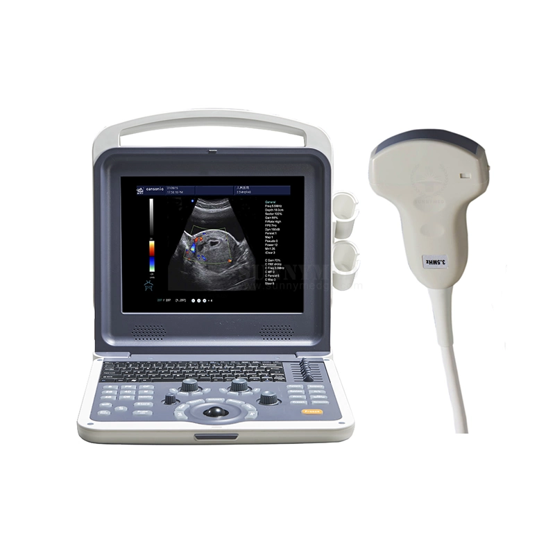 Sy-A042n Cheap Color Doppler Handy Baby Scanner Medical Digital Ultrasonography Ultrasound Machine Price