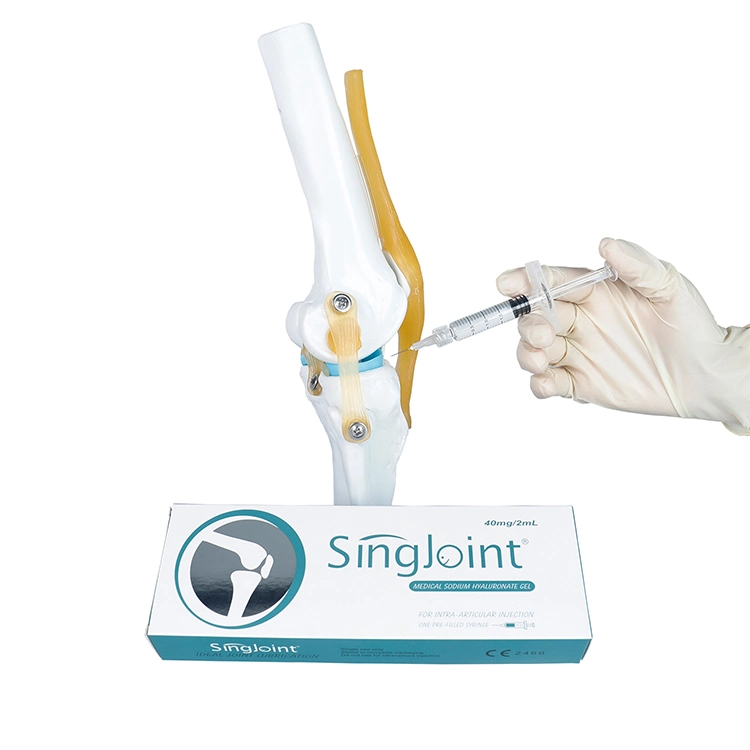 Singjoint Medical Ha for Bone Joint Orthopedics Intra-Articular Injection