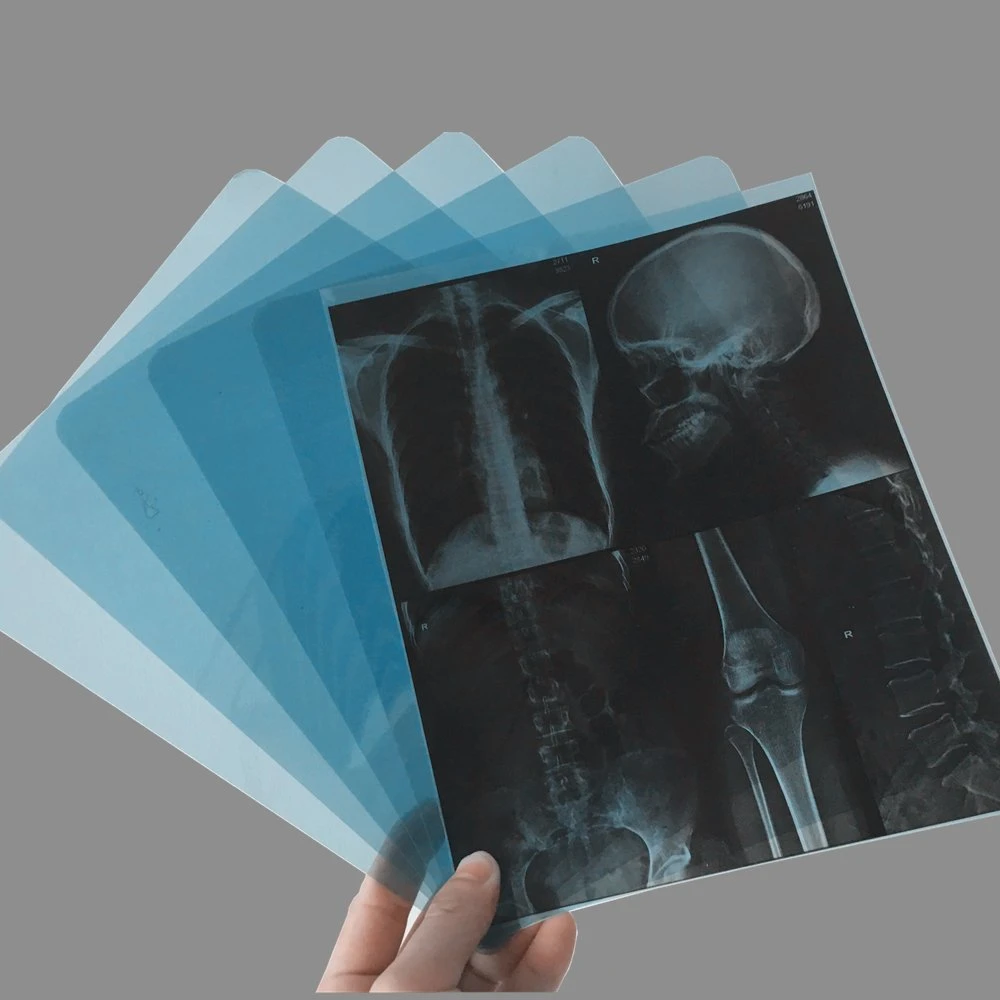 A4 28X35 25X30 Dry Imaging Blue X-ray Medical Film for Inkjet Printers