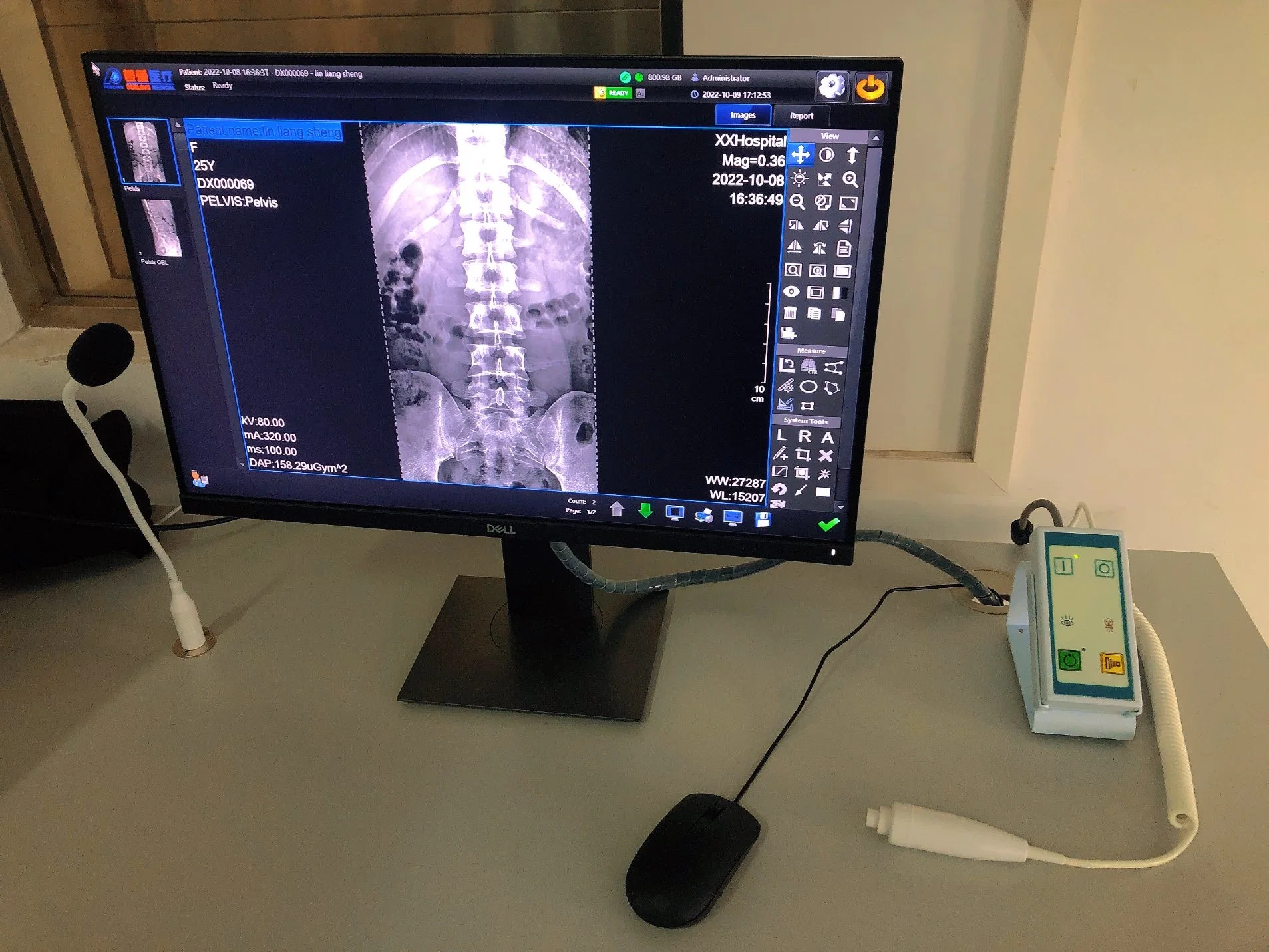 Fixed Digital Radiography and Fluoroscopy System