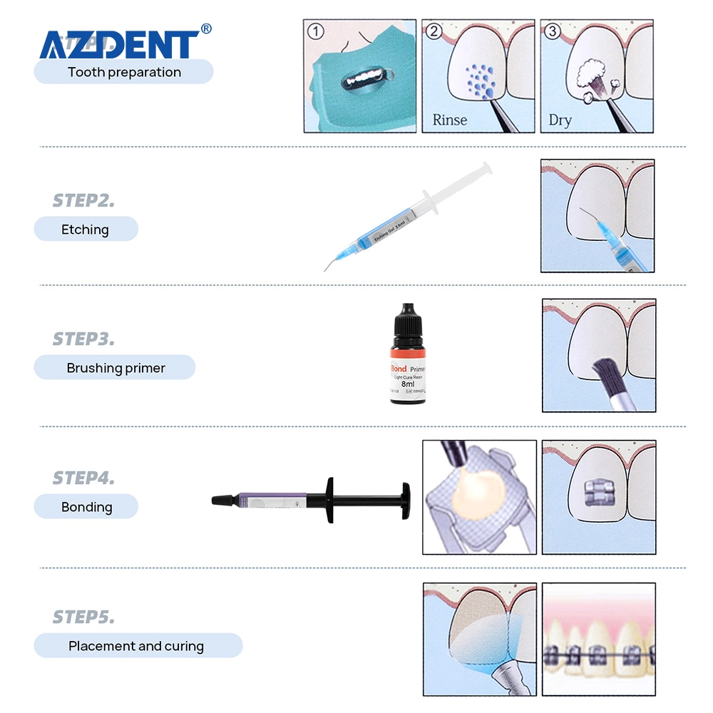 Resina Orthodontica de alta qualidade suportes metálicos adesivo de cura leve Kit com CE