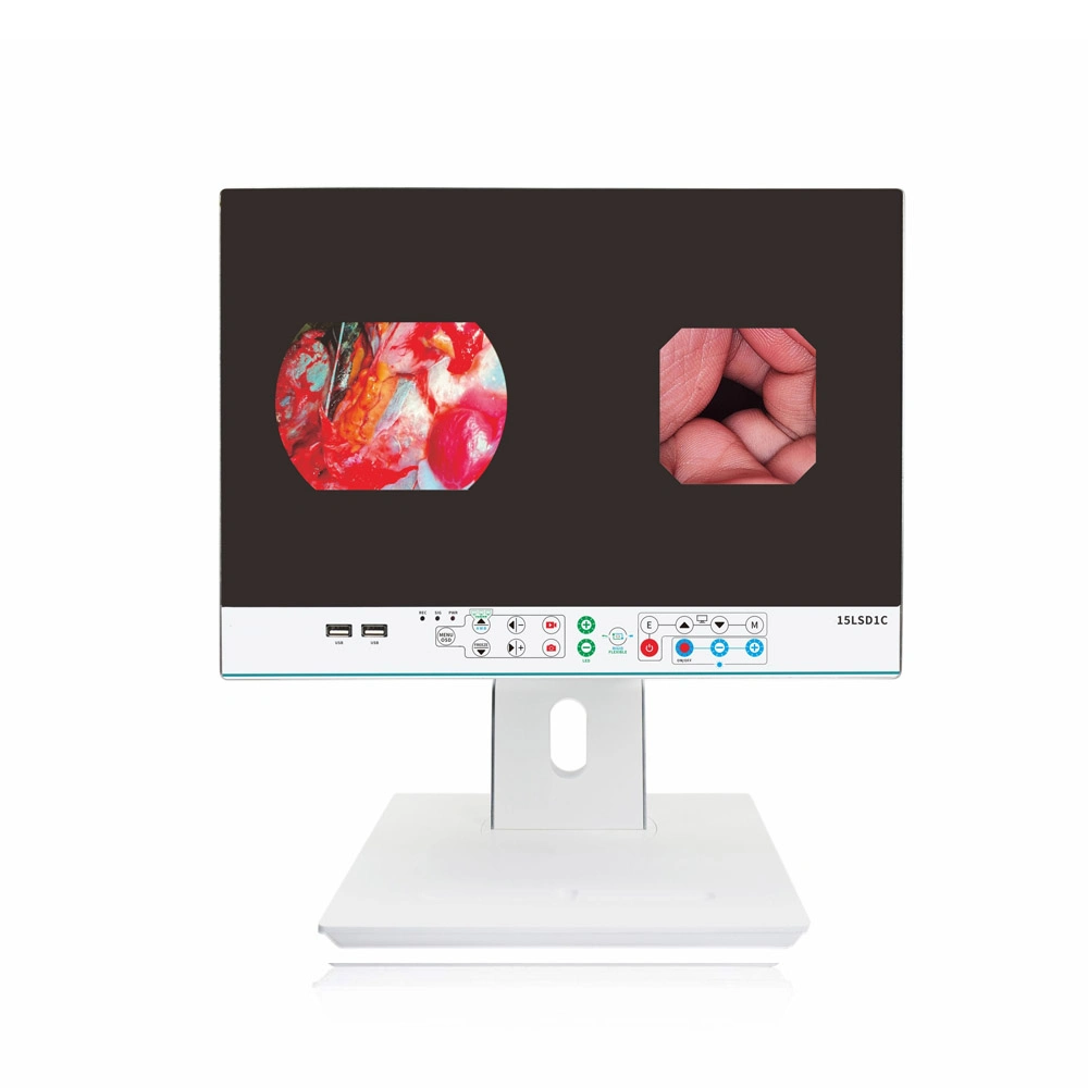 Icen Coms Full HD cámara endoscópica Médico Quirúrgico del sistema de vídeo endoscopio