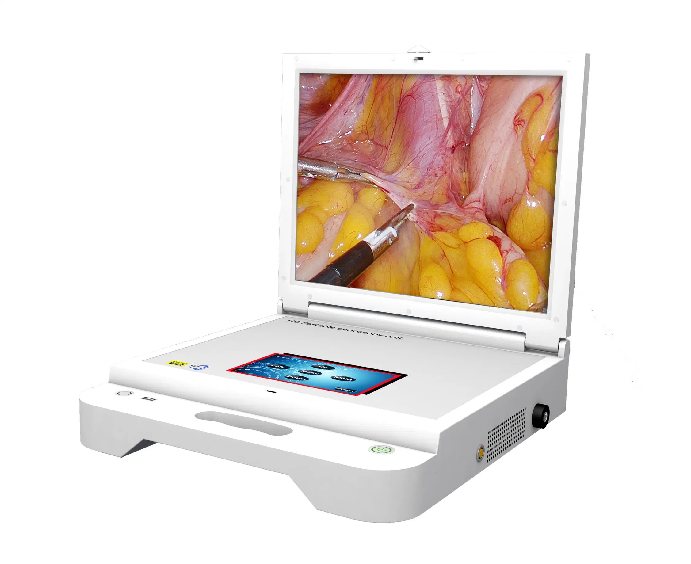 LCD Medical Diagnosis Equipment Endoscope Monitor HD Portable Endoscope System Rigid Endoscopy for Ent
