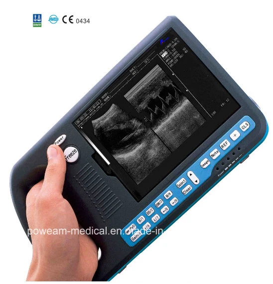 Palmtop Digital Ultrasound Scanner for Human or Veterinary (WHYB3000)