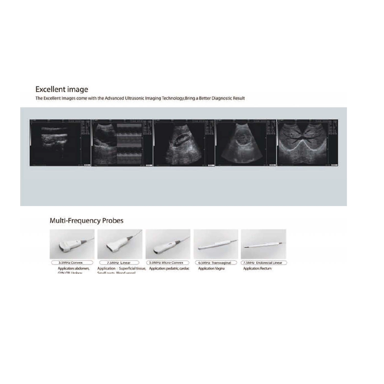 80 Element Digital Trolley Ultrasound Scanner/Ultrasound Machine (PW-9618C)