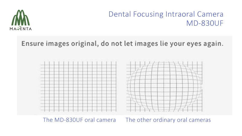 Centrando la longitud focal ajustable con cable USB Cámara Intraoral