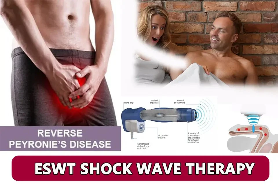 Fisioterapia ondas de choque profesional Shockwave Terapia máquina espalda masajeador para Alivio del dolor en la cintura Relájese