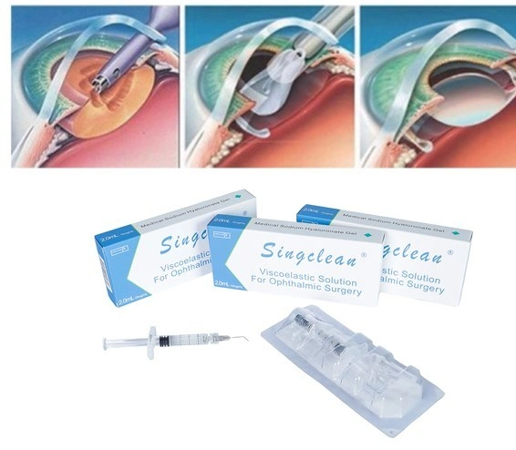 CE Approved High Concentration Medical Products Sodium Hyaluronate Injection for Eye Surgery