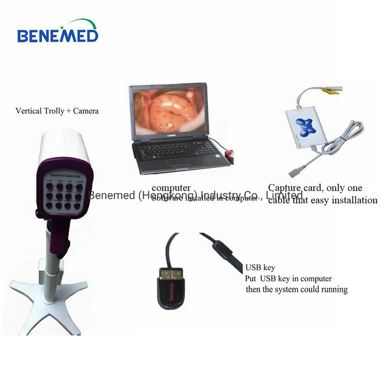 Medical Equipment Digital Video Colposcope for Gynecology