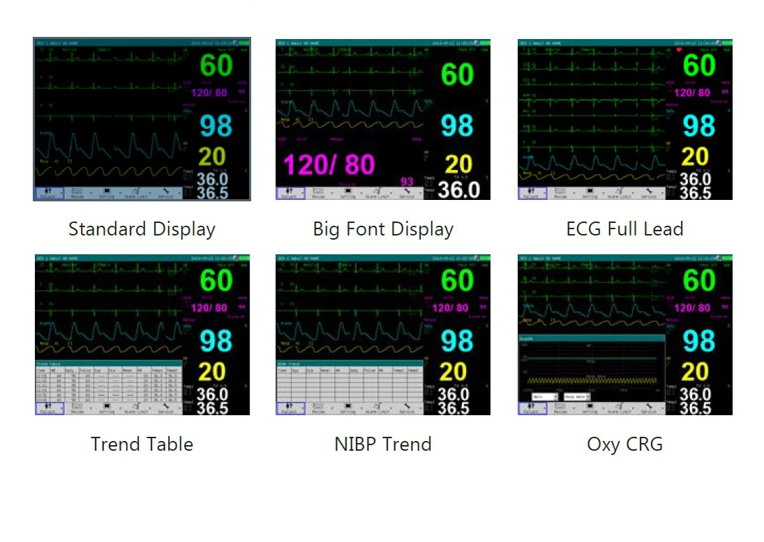 China Supply CE Approved 12.1 Inches Multi-Parameter Patient Monitor