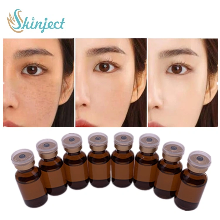 Skinject 5ml Liquid 18 Amino Acids Injection Hyaluronic Acid Meso Serum Injection for Mesotherapy Gun Meso Roller