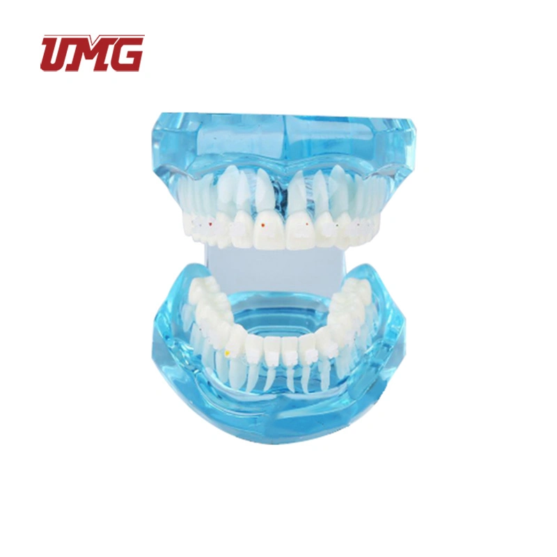 Transparent Dentition with Metal Brackets (3color) Dental Teaching Teeth Model