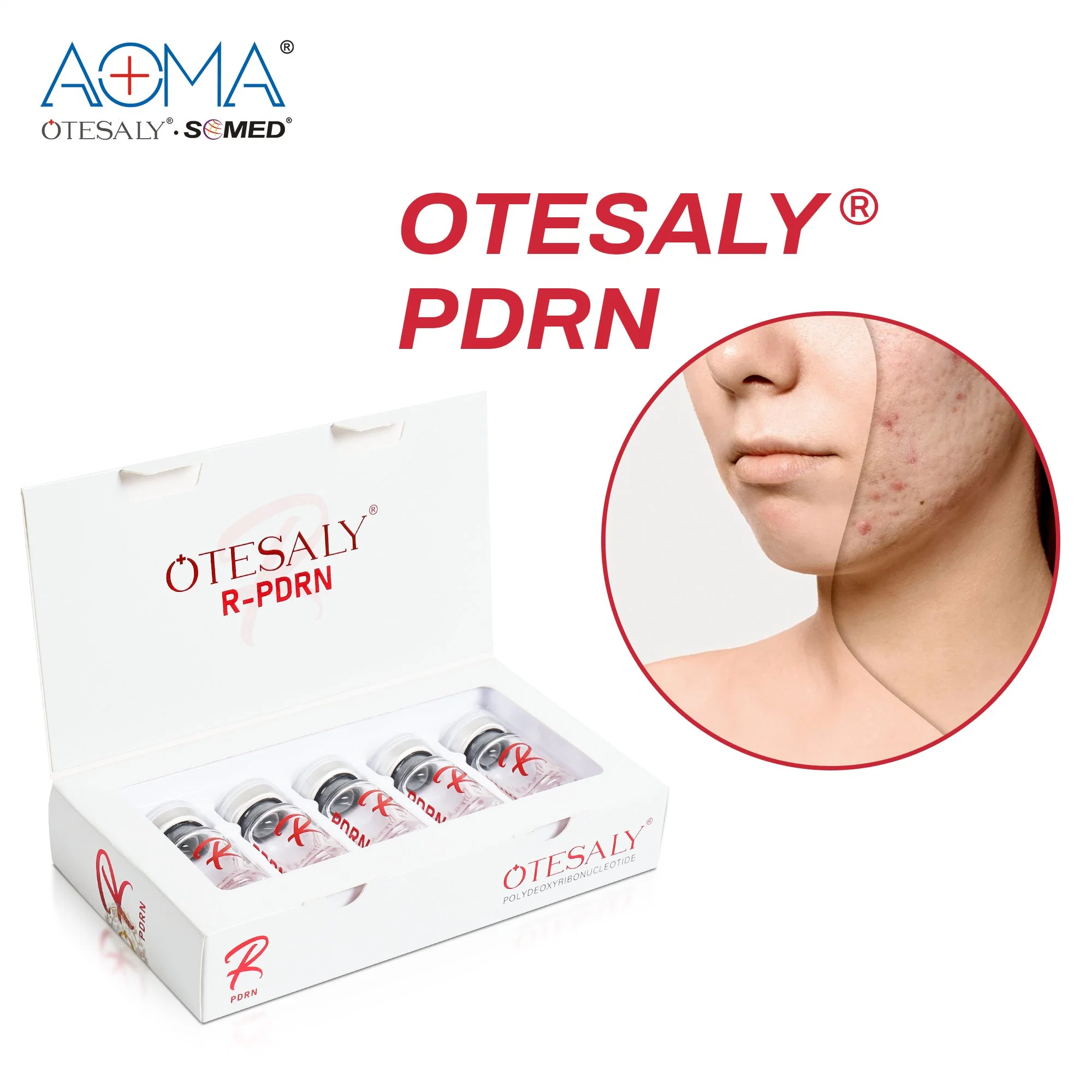 سعر الجملة Otesaly الجلد تجديد النشاط مع حقن Pdrn Hyaluronic معالجة غير مباشرة بالحمض